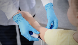 Distribuição das concentrações de lipoproteína(a) em crianças e jovens com hipercolesterolemia familiar em comparação com aqueles sem HF